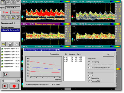 Sonomed-300/A screenshot