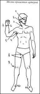 �������� - ��������