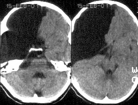 ������� �������������: ���������� ��������