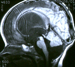 ������� �������������: ���������� ��������