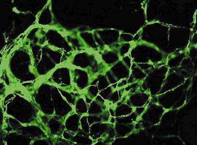 ������������� ��������� ������ ��������